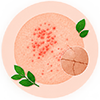 Allergy and skin conditions